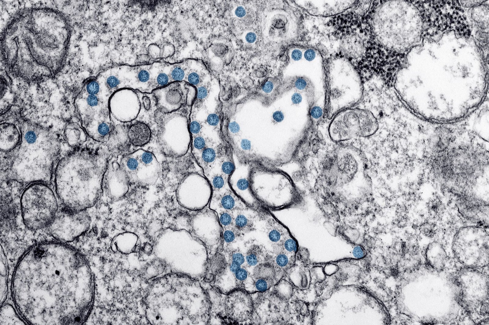 Cyclospora microscope parasite